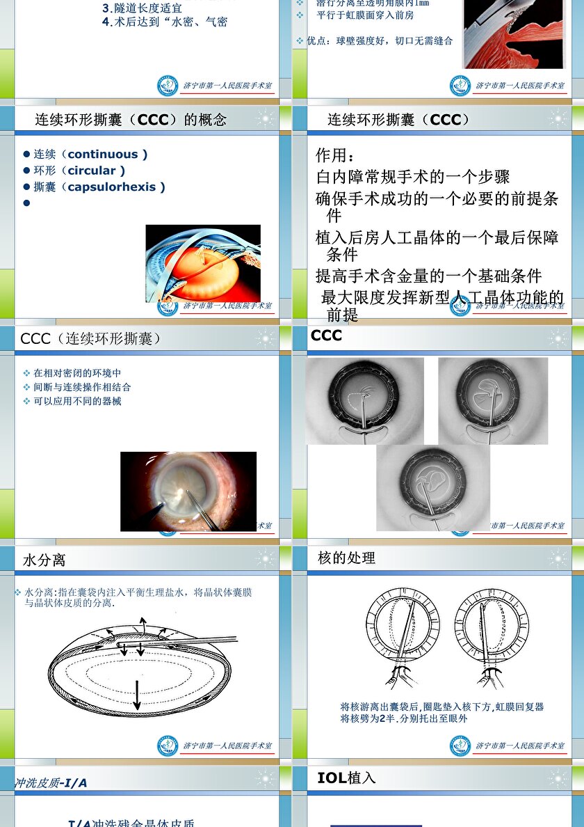 小切口白内障手术图解图片