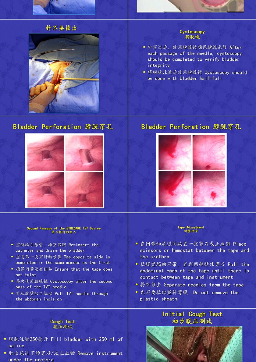 经阴道无张力尿道中段吊带术 Tvt术ppt模板卡卡办公 7768