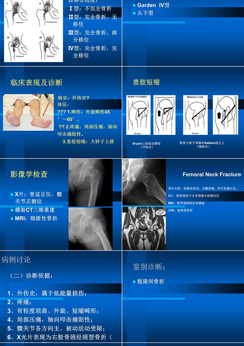 骨科病例ppt图片