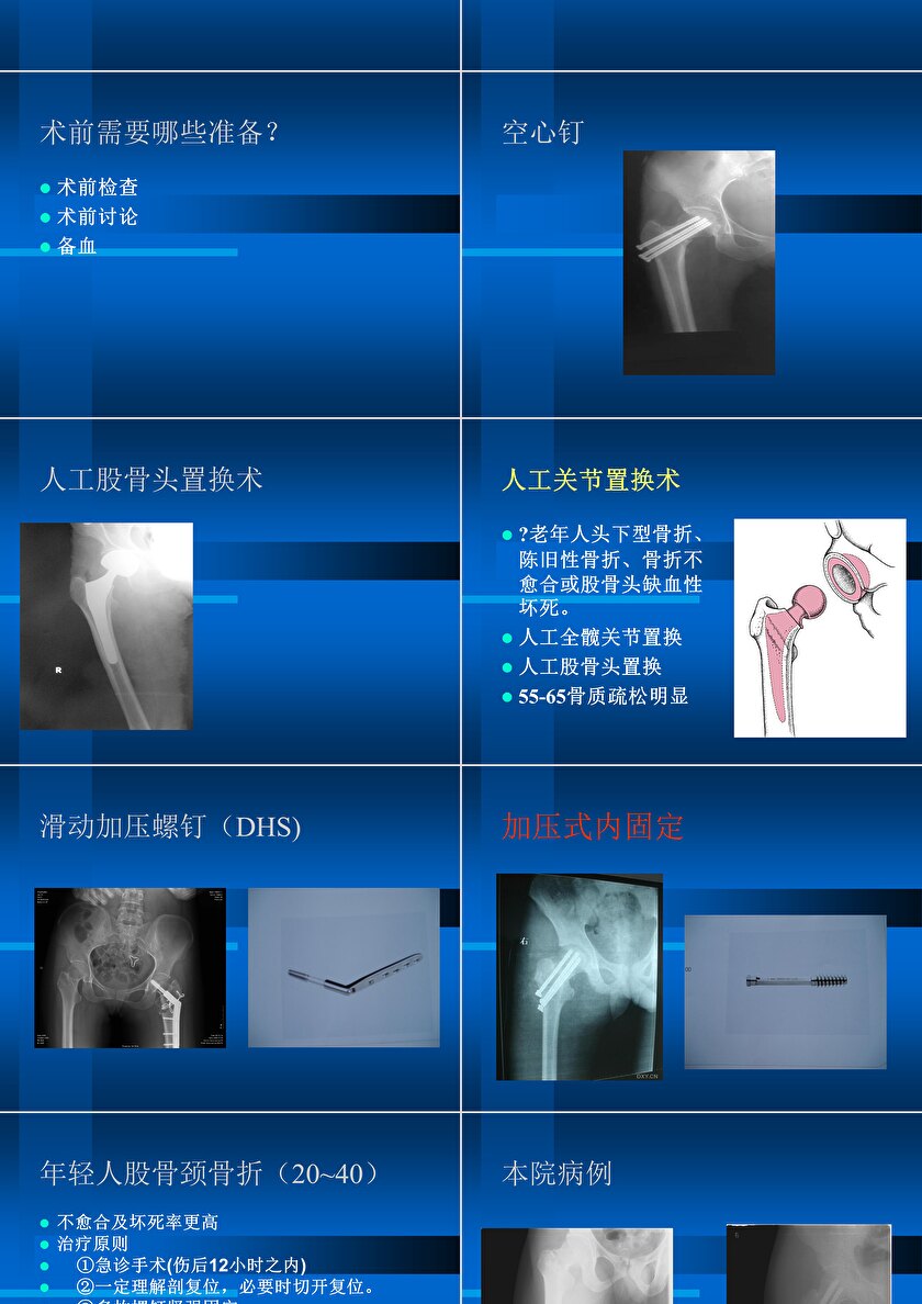 骨科病例ppt图片