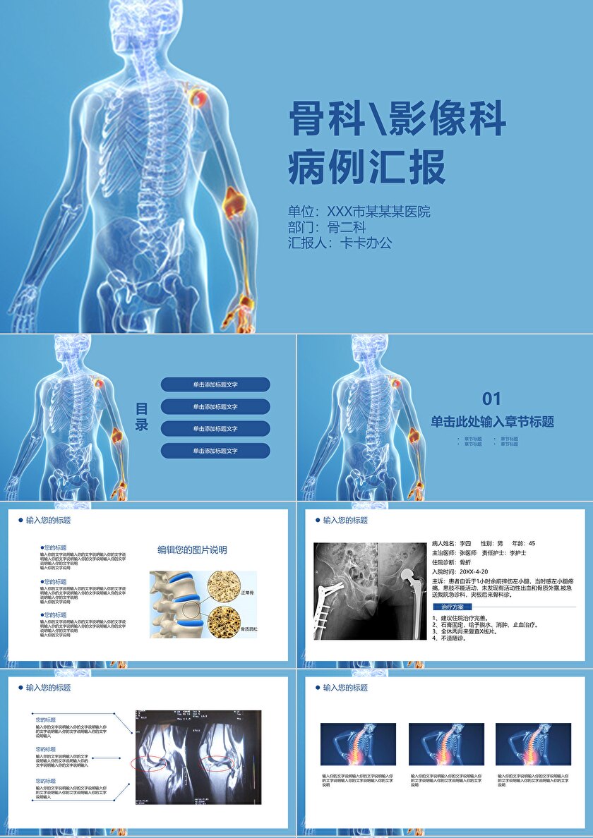 骨科病例ppt图片